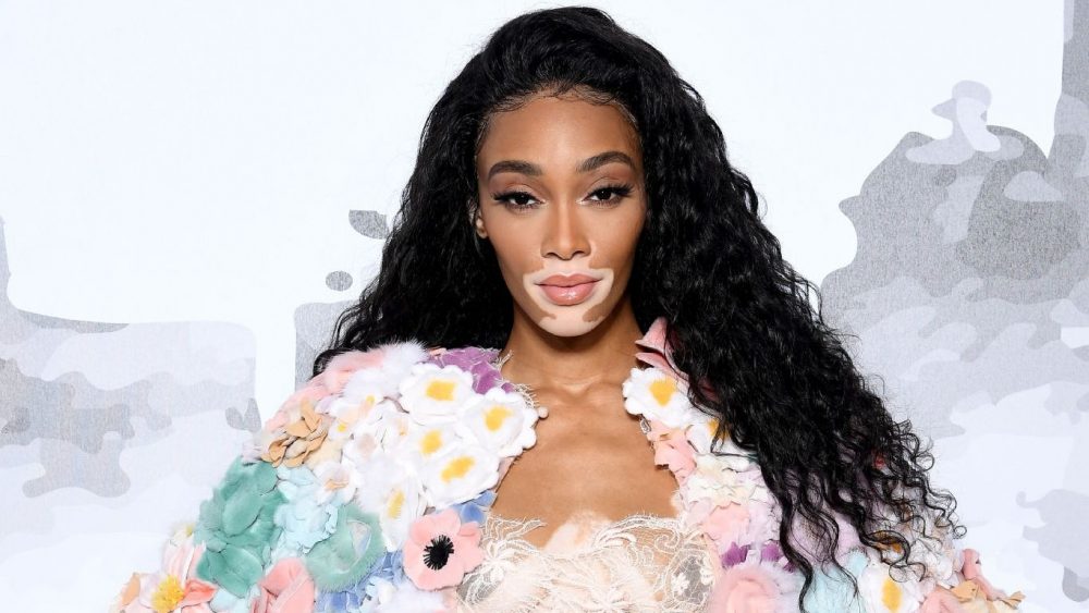 Winnie Harlow