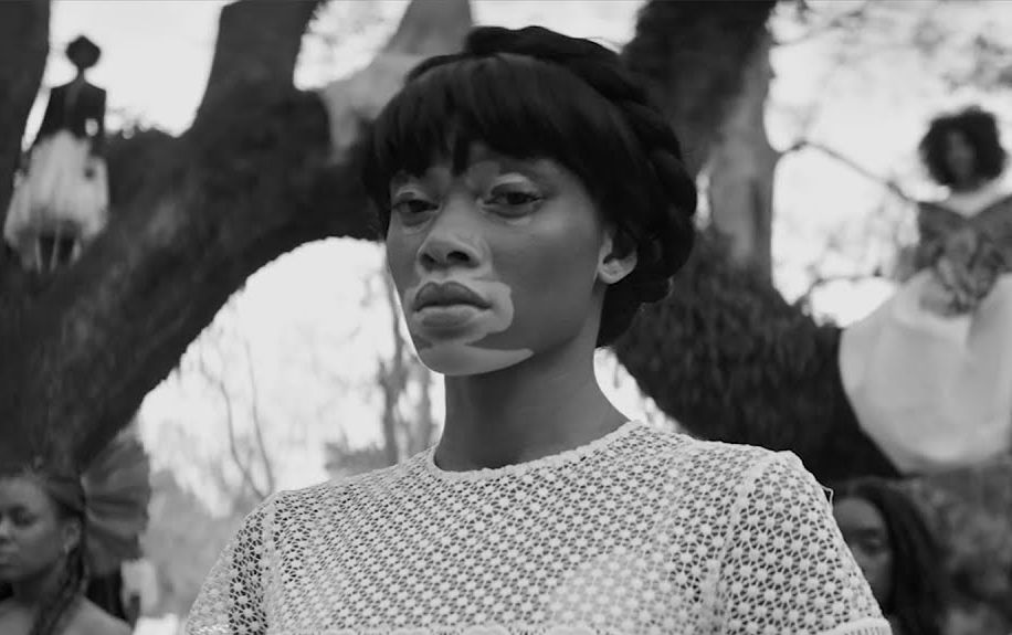 Winnie Harlow