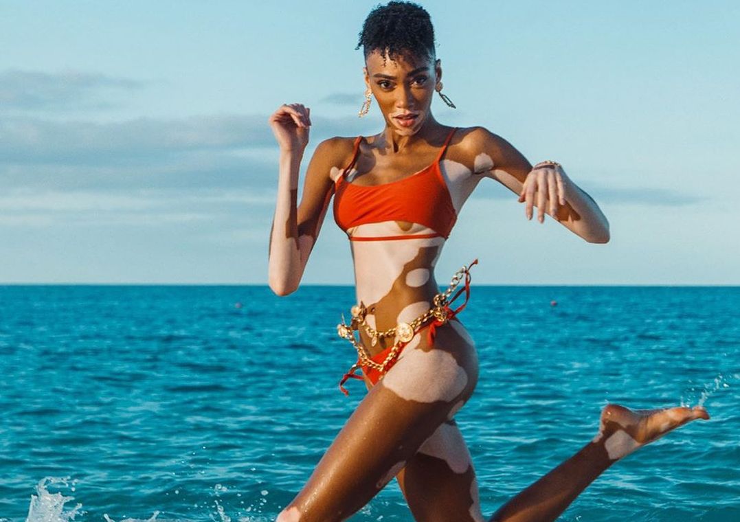 Winnie Harlow
