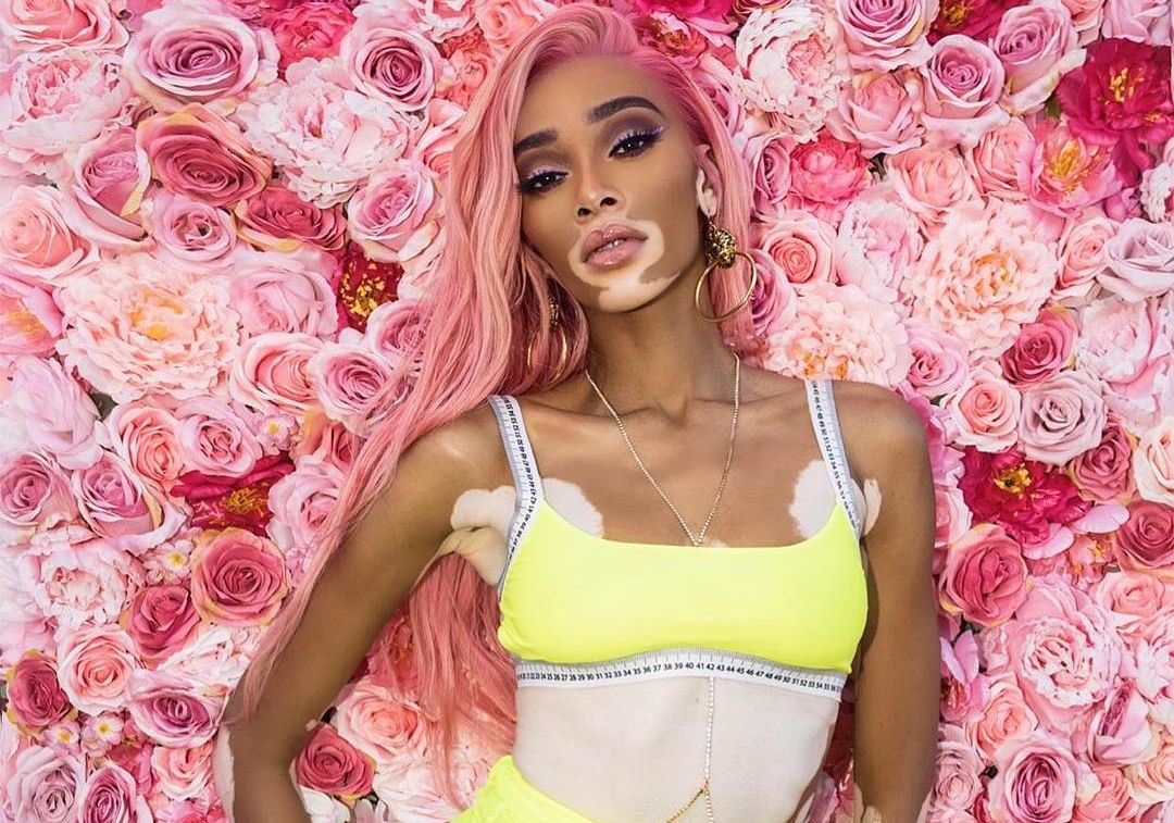 Winnie Harlow