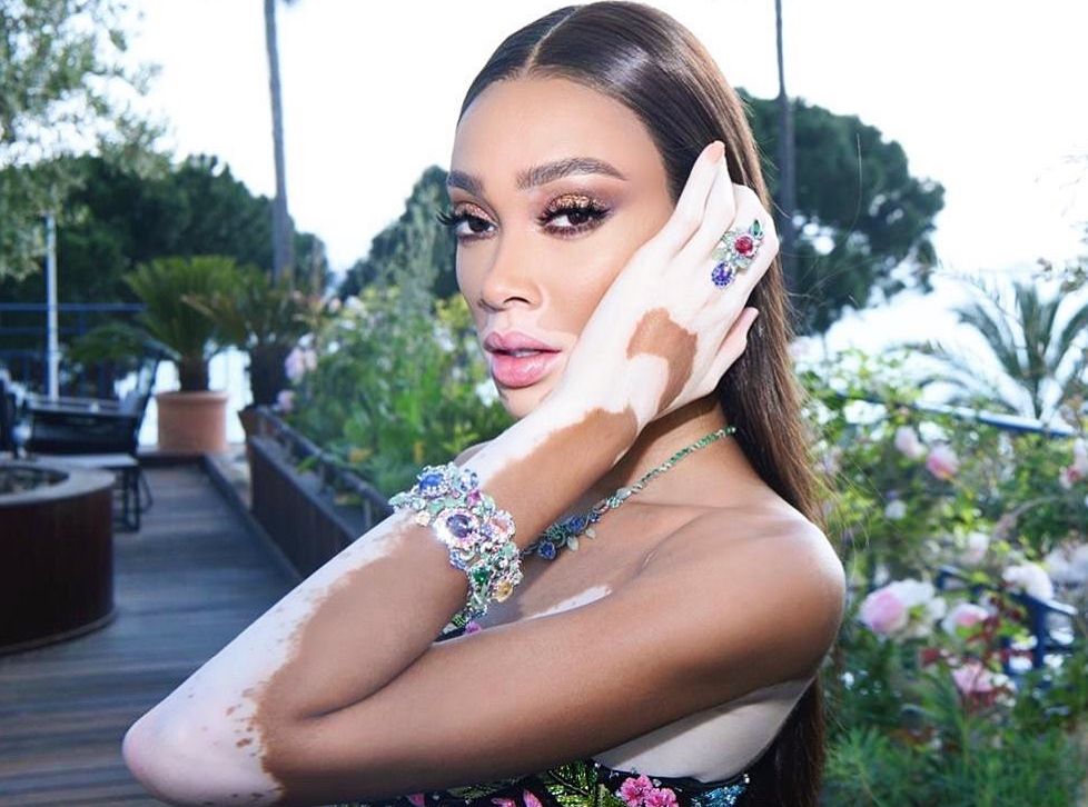 Winnie Harlow
